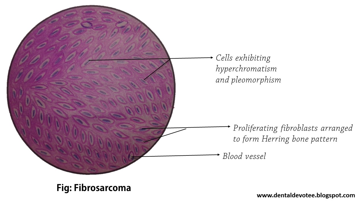 Dentosphere World of Dentistry Oral Pathology Histopathological
