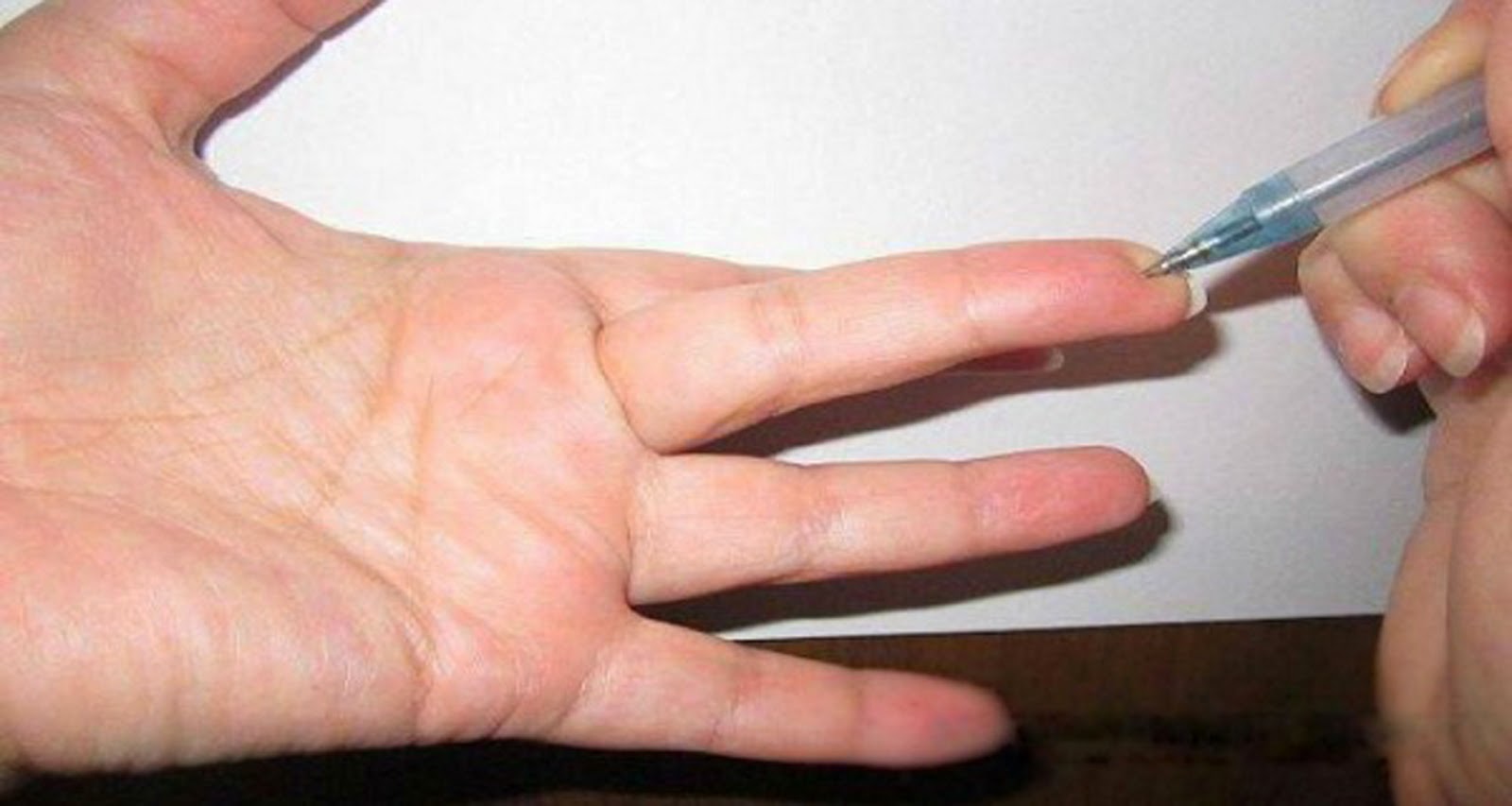 Пальцы колет иголками. Точка на среднем пальце. Точка на подушечке среднего пальца. Точка на среднем пальце для снижения давления. Особая точка на пальце руки.