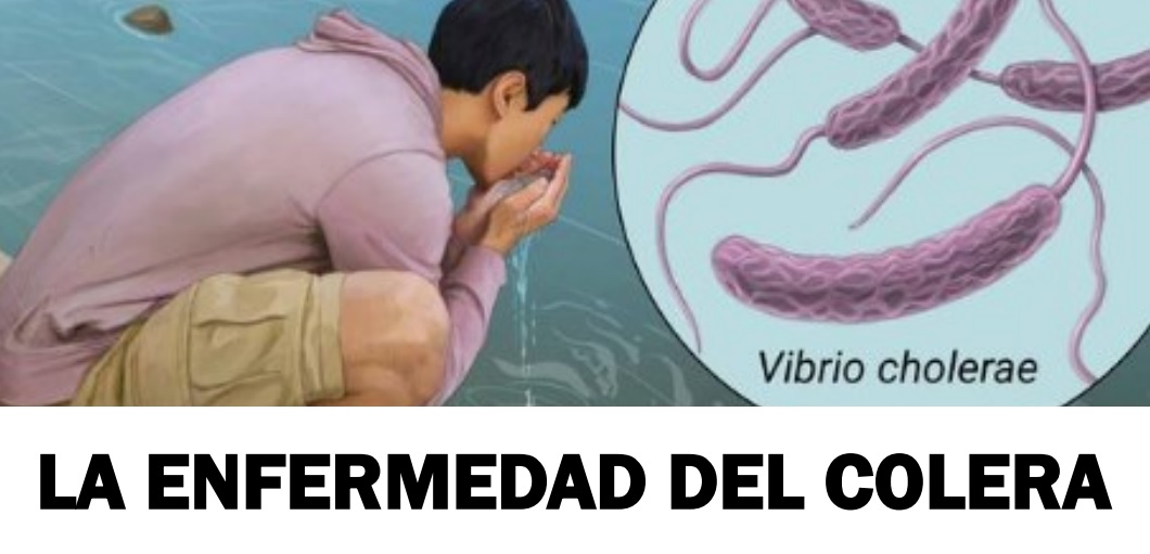 El cólera