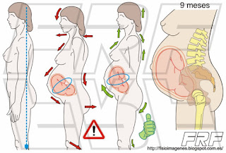 Modificación postural durante el embarazo.