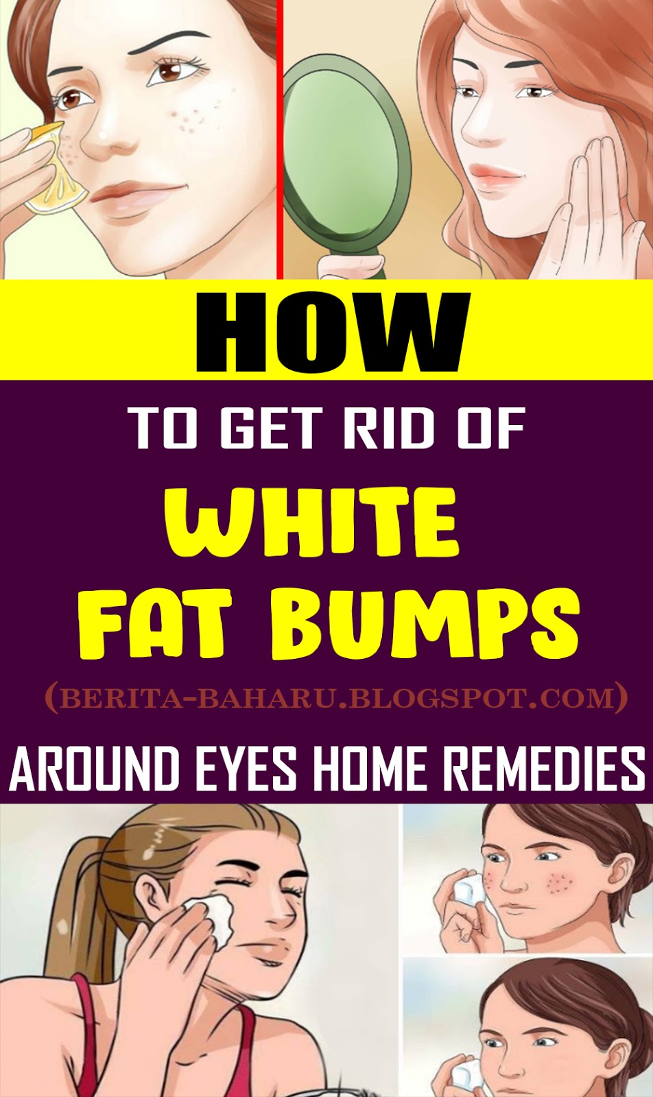 home-remedies-to-get-rid-of-white-fat-bumps-around-eyes-naturally