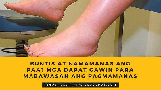 Buntis at Namamanas ang Paa? Mga Dapat Gawin Para Mabawasan ang