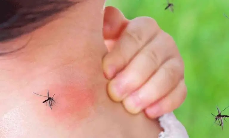 Malaria .. its symptoms and how to treat it
