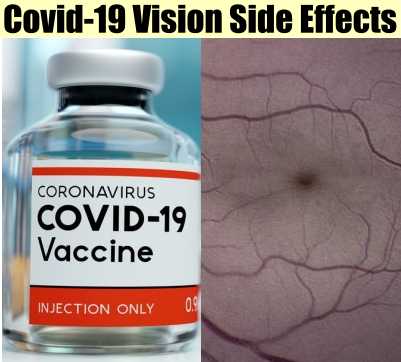 COVID-19-Vaccine-Side-Effects
