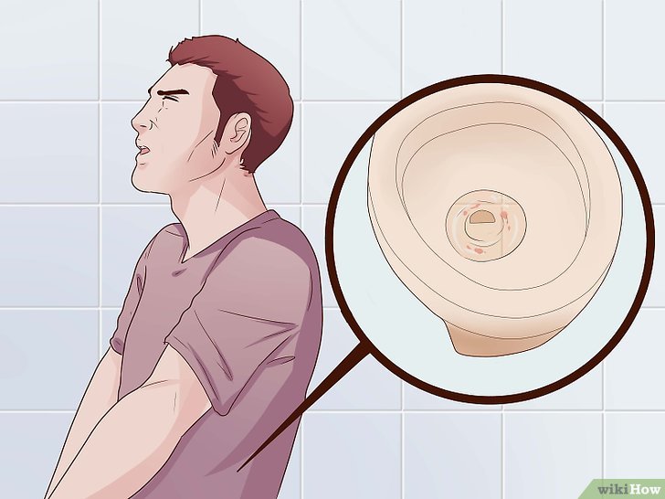 Obat Sipilis Di Puskesmas