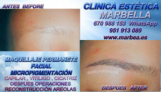 micropigmentyación Málaga clínica estetica propone los deseable servicio para micropigmentyación, maquillaje permanente de cejas en Málaga y marbella