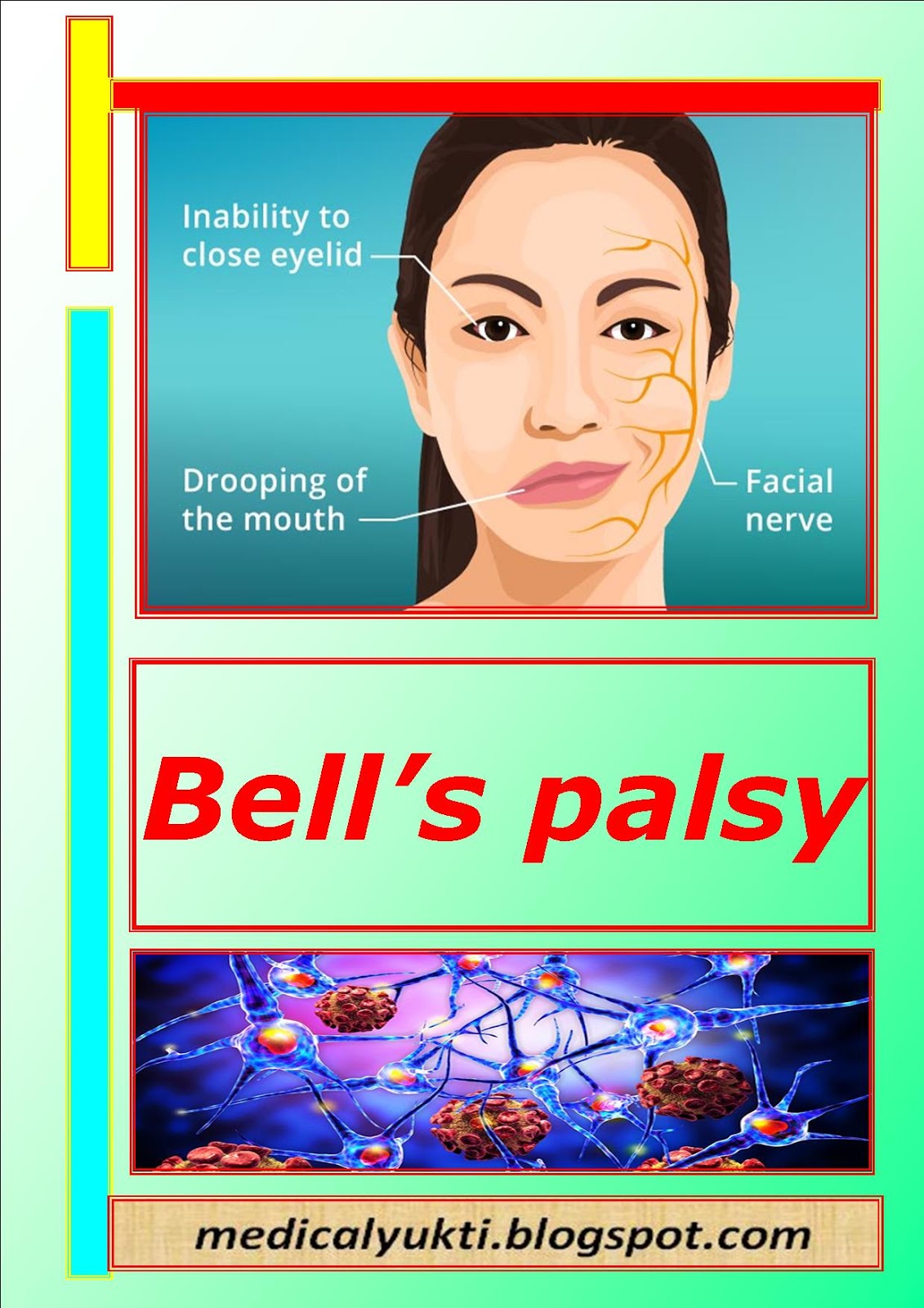 Bell's palsy Medical Yukti
