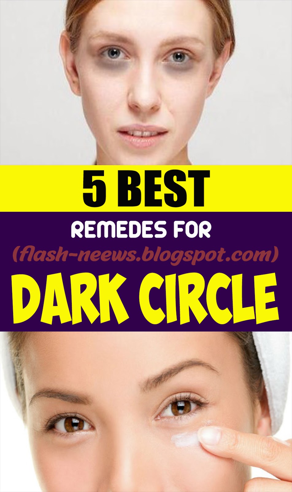 5 MOST EXCELLENT HOME REMEDIES FOR DARK CIRCLES HEALTH and WELLNESS