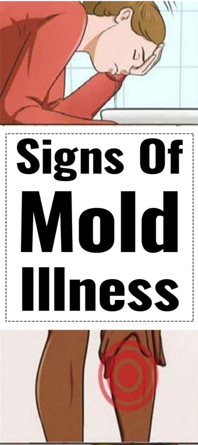 Mold Illness and how to spot them wellness magazine