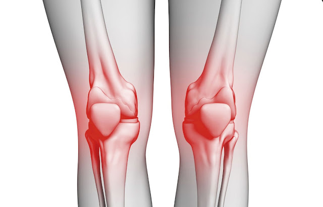 ما هو التهاب المفاصل