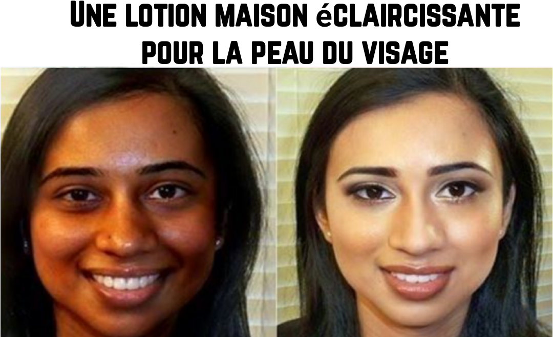 Une lotion éclaircissante visage fait maison