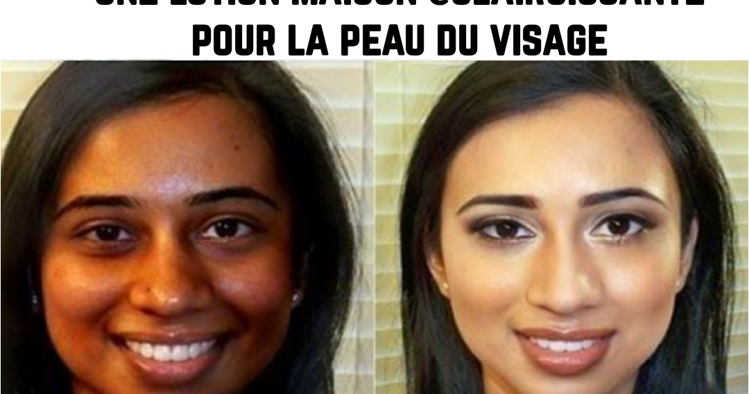Une lotion éclaircissante visage fait maison