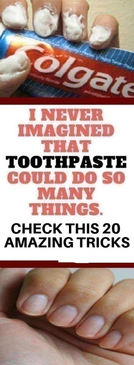 I Never Imagined That Toothpaste Could Do So Many Things. Check These