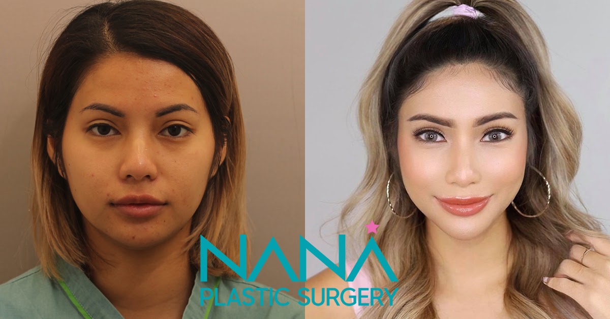 NANA REAL REVIEW PART 2 EYETA มาทุบหน้าใหม่ที่เกาหลี สวยจบครบวันเดียว