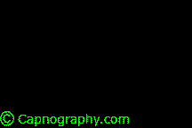 CAPNOGRAPHY TRONG GÂY MÊ Ở NGƯỜI LỚN
