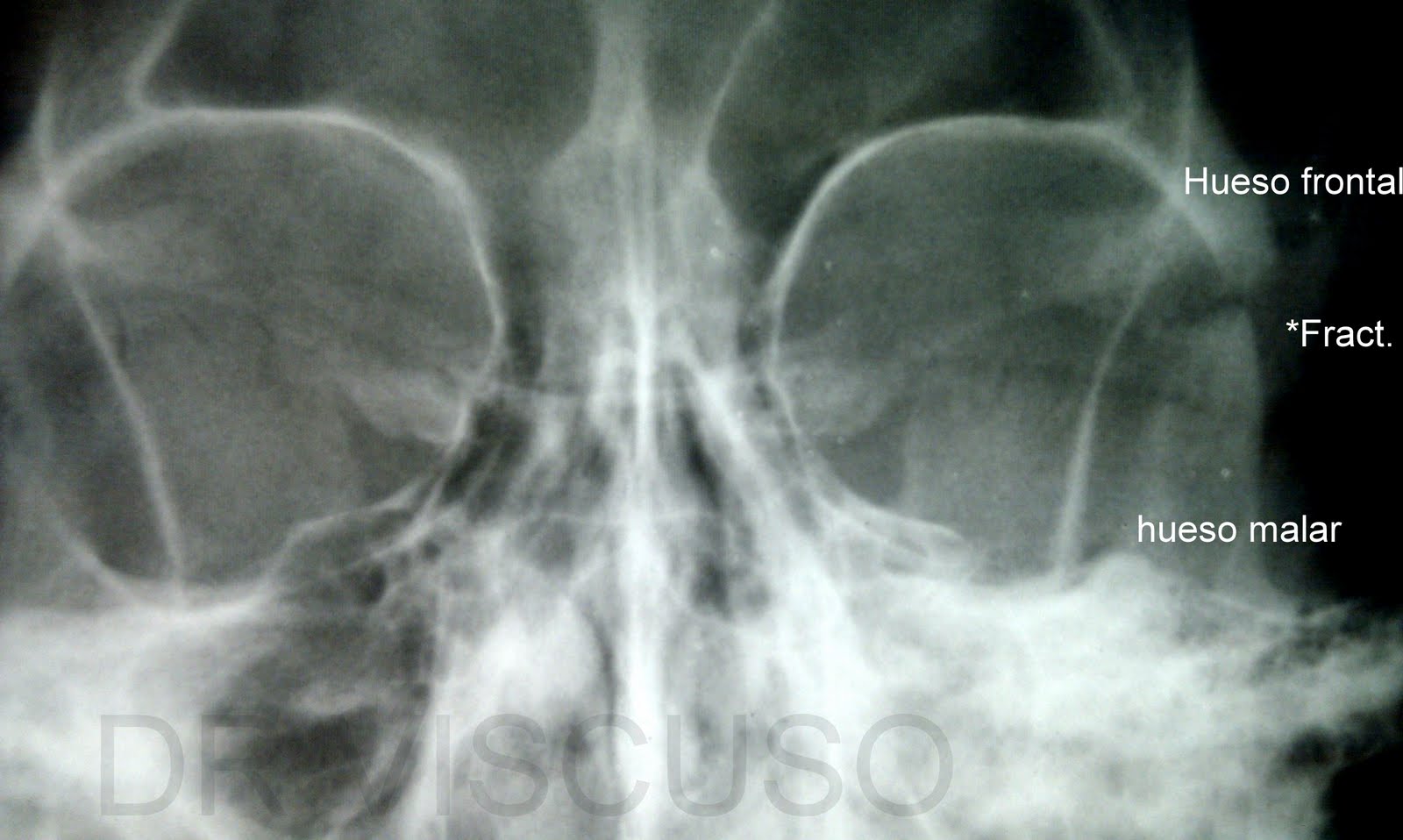 Que vi hoy: Con un caño.....