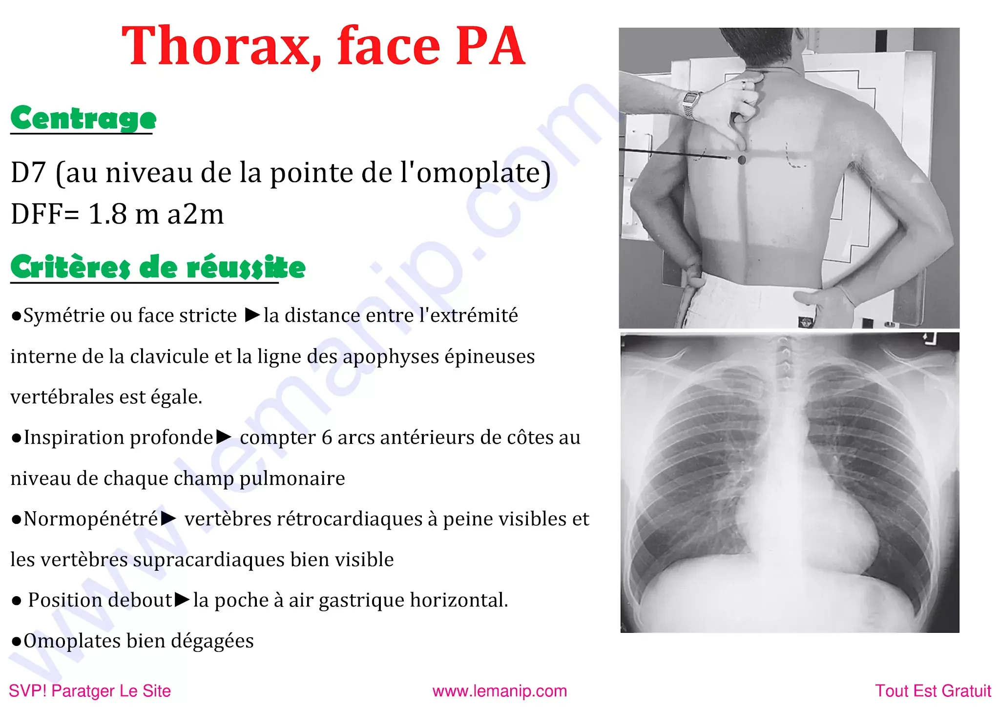 Thorax