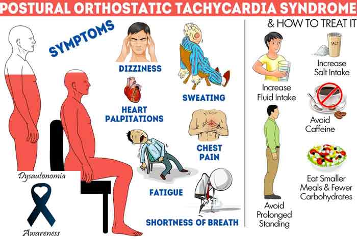 Postural Orthostatic Tachycardia Syndrome A Dermatologic Perspective and  Successful Treatment with Losartan, JCAD