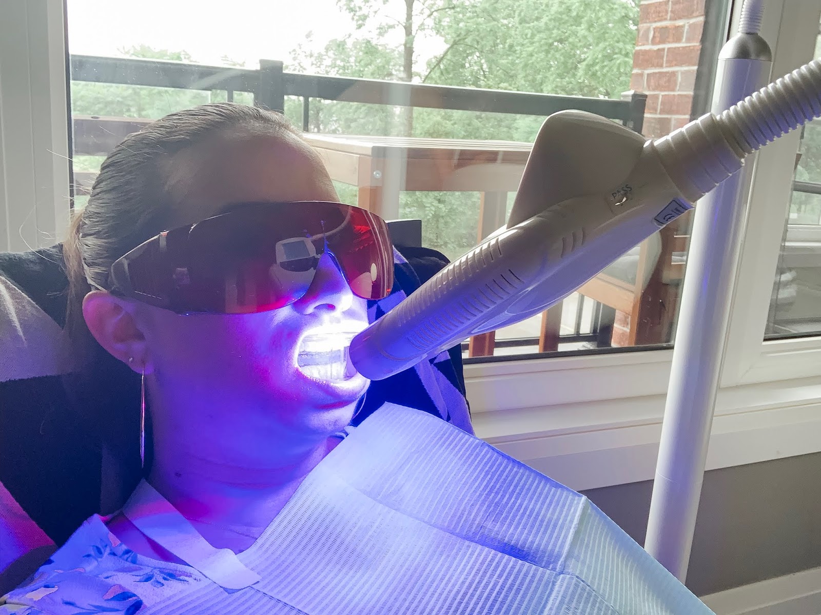 LED Teeth Whitening What You Need to Know SIMPLY SUPPA