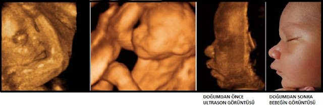 23. haftada bebeğin görüntüsü