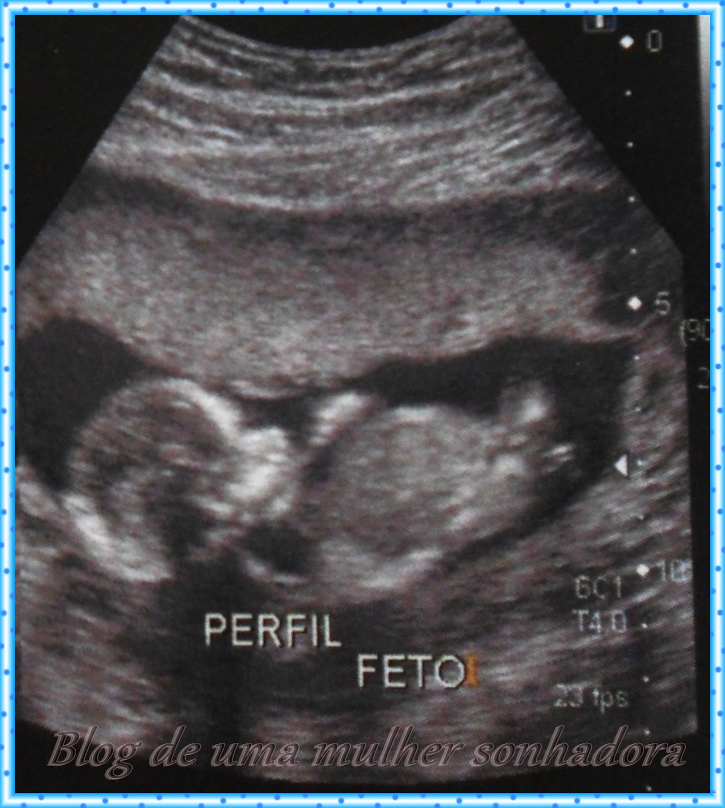 .: 3ª Ultrassonografia do bebê + foto da barriga de 4 meses...