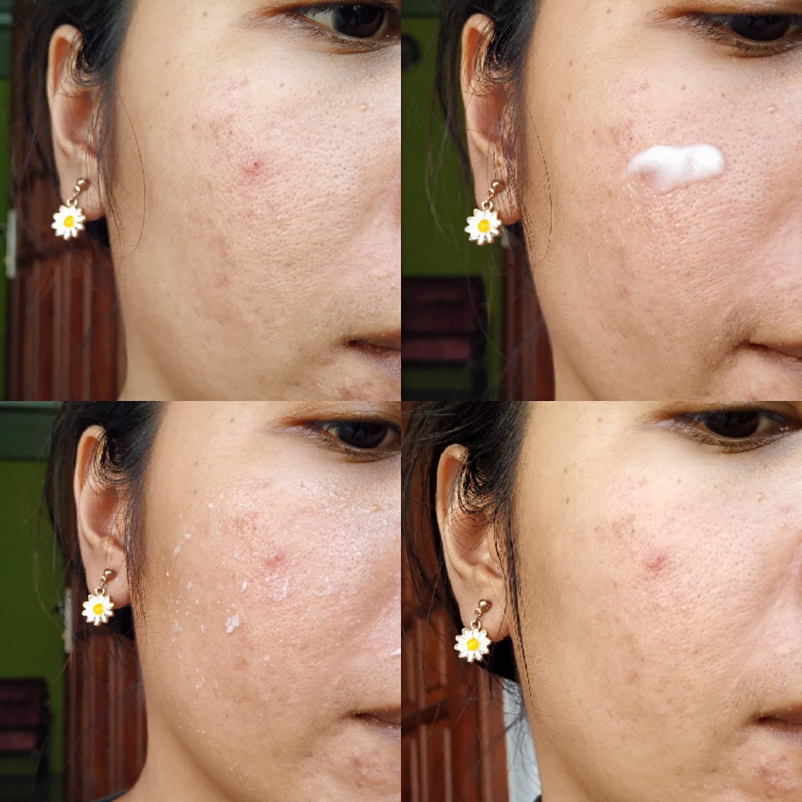 BENTON PHA PEELING GEL THE BEST PEELING GEL FOR SENSITIVE ACNE PRONE