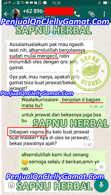 Obat Tradisional Benjolan Di Wajah Terampuh ini TERBUKTI SANGAT Manjur !! Obat Tradisional Benjolan Di Wajah Terampuh ini TERBUKTI SANGAT Manjur !!