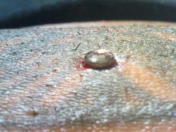 Dermal