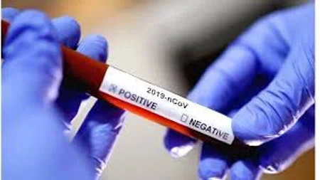 Idukki politician's 3rd test returns negative for coronavirus, Thodupuzha, News, Local-News, Trending, Health, Health & Fitness, Politics, Congress, Leader, Kerala