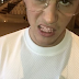 Justin Bieber gets new pink sapphire teeth worth $15,000 
