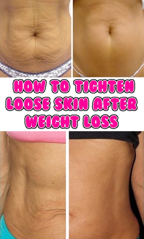 Style Craze Fitness How to Tighten Loose Skin After Weight Loss
