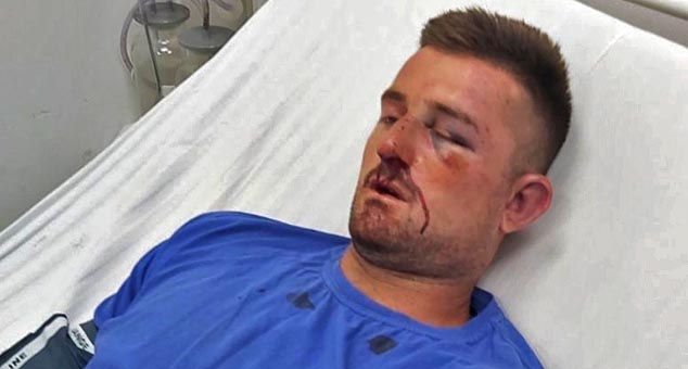 Two Albanians severely beat a 23-year-old Nikola Perić in a meadow by the road for no reason.