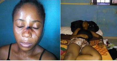 LECTURER OF AUCHI POLYTECHNIC ESCAPES DEATH FROM STUDENTS OVER ASSAULT OF A FEMALE STUDENT