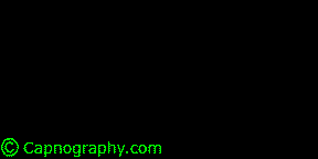 CAPNOGRAPHY TRONG GÂY MÊ Ở NGƯỜI LỚN