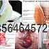 Apakah AmbeJOSS Obat Wasir yg dimasukkan Dubur thumbnail