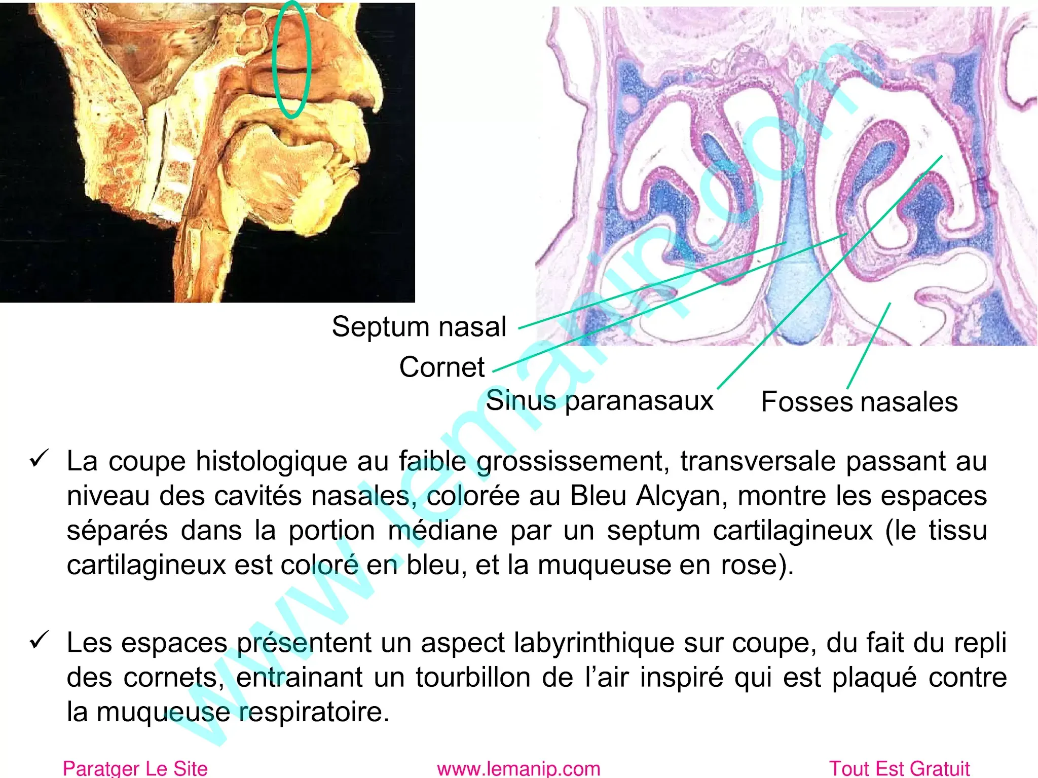 Coupe histologique des cavités nasales