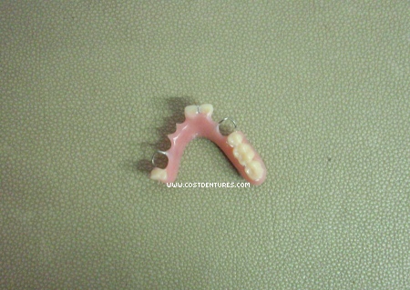 Dentures Near Me >> DENTAL CLINIC IN MOTI NAGAR, KIRTI NAGAR, SHADI PUR NEW DELHI: January 2013 Dentures Near Me >> DENTAL CLINIC IN MOTI NAGAR, KIRTI NAGAR, SHADI PUR NEW DELHI: January 2013