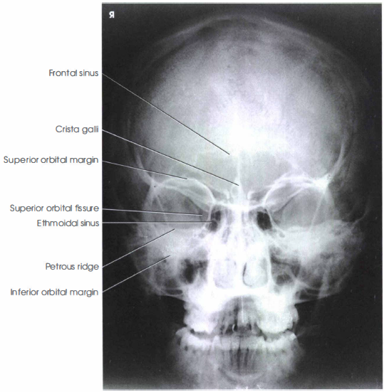 facial bone x ray