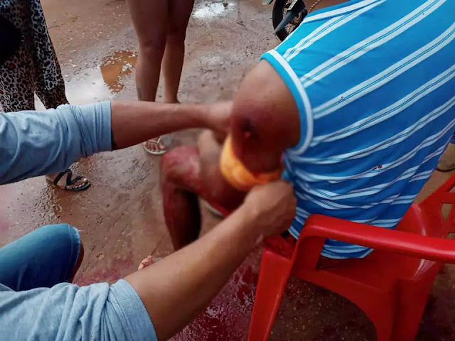 Vítima é baleada durante tentativa de roubo em Guajará-Mirim – IMAGENS FORTES 6 Vítima é baleada durante tentativa de roubo em Guajará-Mirim – IMAGENS FORTES