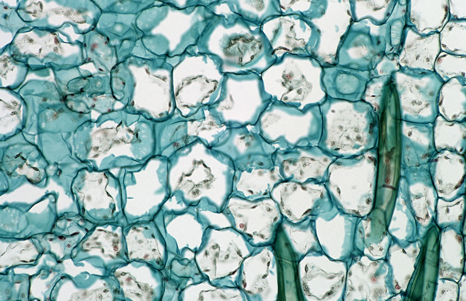 My Blogg LATICIFERS Introduction, Structure, Classification and Functions