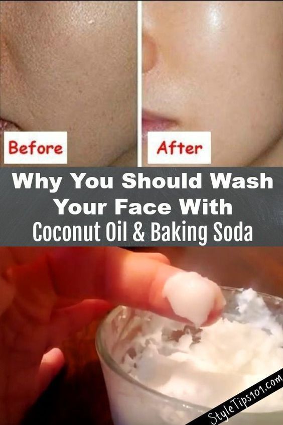 COCONUT OIL AND BAKING SODA FACE WASH FOR AGING OR ACNE PRONE SKIN