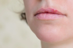 Bump on the Human Lips(Lips Infection)