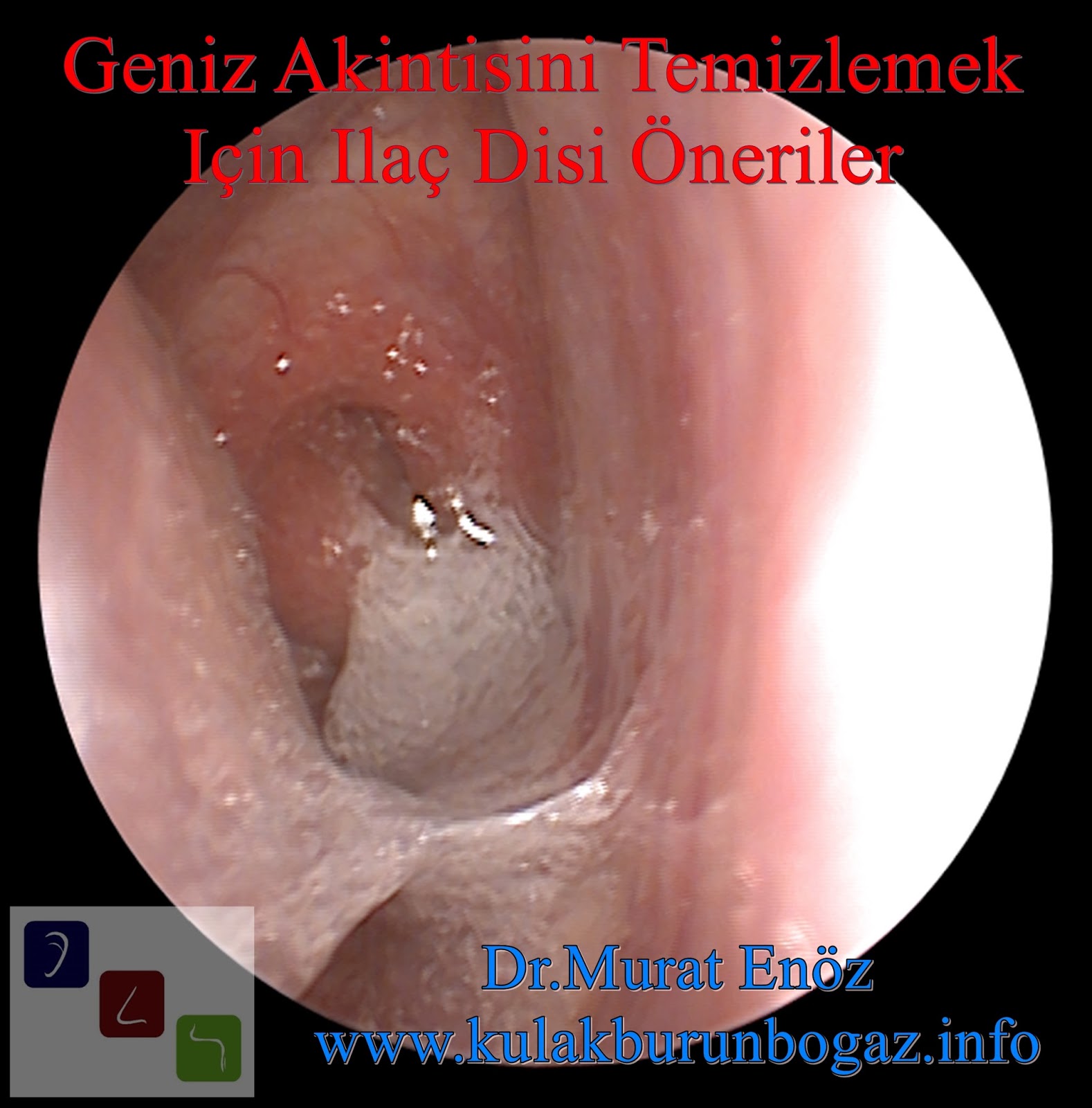 Geniz Akıntısını Temizlemek İçin İlaç Dışı Öneriler KBB Uzmanı Bakırköy