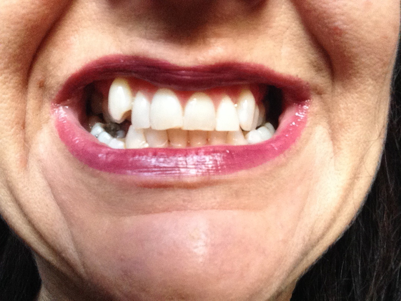 A Journey with my Teeth Marking Middle Age with My Teeth!