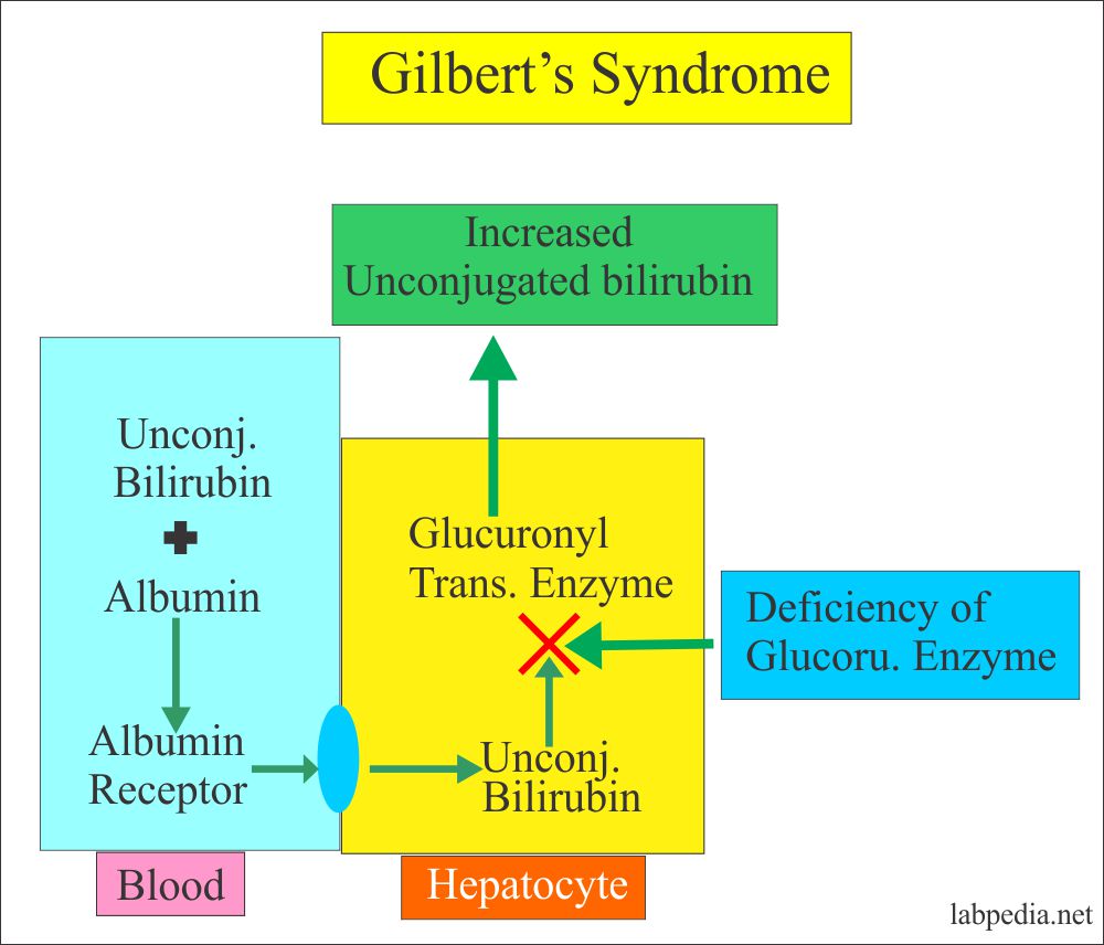 gilbert-s-syndrome