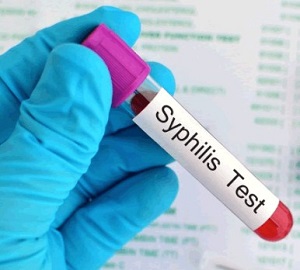 Jual Obat Sipilis Yang Bagus dan Ampuh Jual Obat Sipilis Yang Bagus dan Ampuh