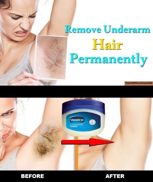 How To Remove Underarm Hair Permanently At Home?