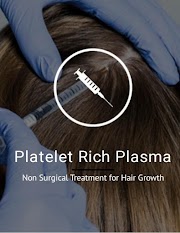 Platelet Rich Plasma ( Non Surgical Treatment for Hair Growth ).