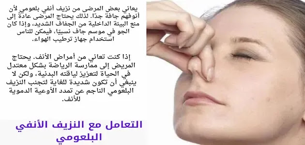 الخطأ والصواب في التعامل مع نزيف الأنف التعامل مع النزيف الأنفي البلعومي
