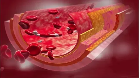 The Different Types of Cholesterol The Different Types of Cholesterol